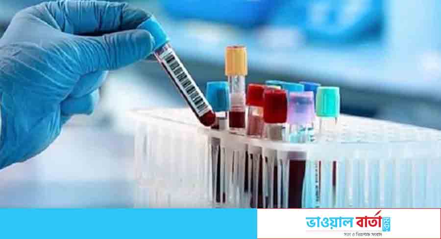 ঢাকায় ৭১ ও চট্টগ্রামে ৫৫ শতাংশ মানুষের শরীরে অ্যান্টিবডি